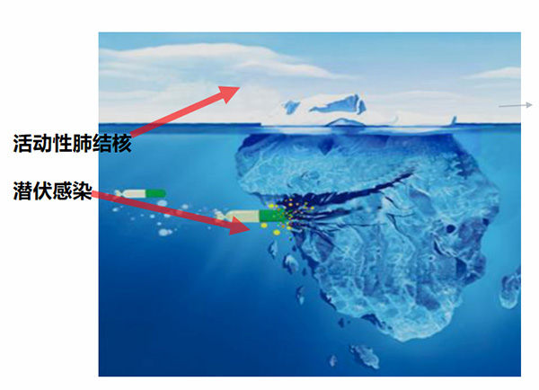 潤心科(ke)普｜沉默的(de)健康隐患——結核潛伏感染