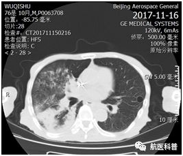 微信(xin)圖片_20191122115404.jpg 微信(xin)圖片_20191122115404.jpg
